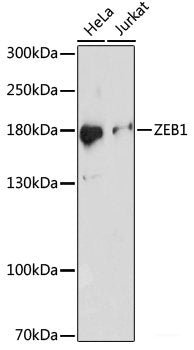 Immunofluorescence analysis of U-2OS cells using LIG4 Polyclonal Antibody at dilution of  1:100. Blue: DAPI for nuclear staining.
