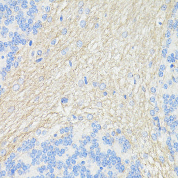 Immunohistochemistry of paraffin-embedded Human tonsil using CD3E Polyclonal Antibody at dilution of  1:200 (40x lens).