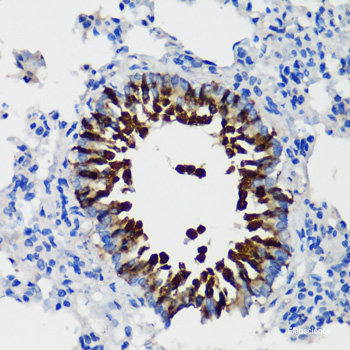 Immunohistochemistry of paraffin-embedded Human tonsil using FKBP1A Polyclonal Antibody at dilution of  1:200 (40x lens).