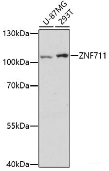 Immunohistochemistry of paraffin-embedded Human amygdalitis using FTL Polyclonal Antibody at dilution of  1:100 (40x lens).