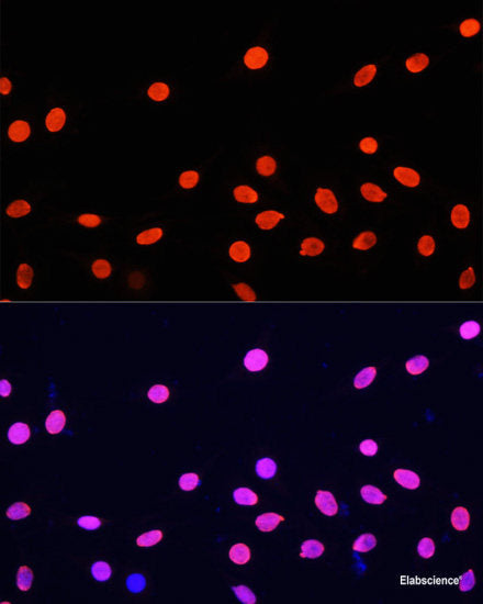 Immunohistochemistry of paraffin-embedded Human stomach using Cyclin D2 Polyclonal Antibody at dilution of  1:100 (40x lens).
