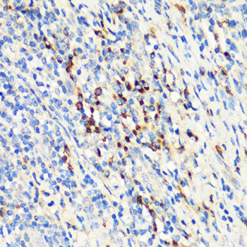 Immunofluorescence analysis of U-2 OS cells using IGF2BP2 Polyclonal Antibody at dilution of  1:100. Blue: DAPI for nuclear staining.