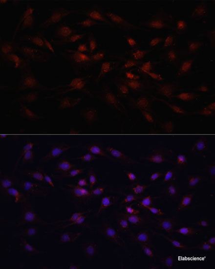 Immunohistochemistry of paraffin-embedded Rat kidney using GGT1 Polyclonal Antibody at dilution of  1:100 (40x lens).