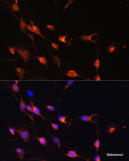 Immunohistochemistry of paraffin-embedded Human colon using CD82 Polyclonal Antibody at dilution of  1:100 (40x lens).