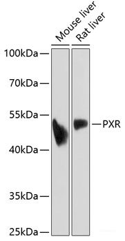 Western blot analysis of extracts of various cell lines using AKR1C3 Polyclonal Antibody at dilution of 1:1000.