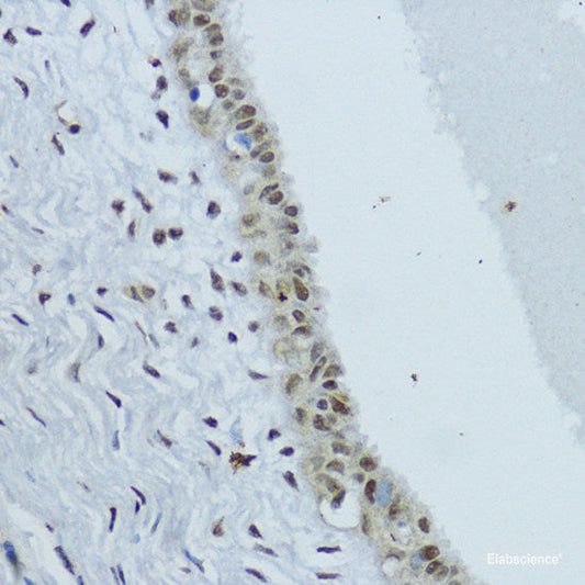 Western blot analysis of extracts of various cell lines using VEGF Monoclonal Antibody at dilution of 1:500.