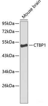 Immunohistochemistry of paraffin-embedded Rat kidney using PDE3A Polyclonal Antibody at dilution of  1:100 (40x lens).
