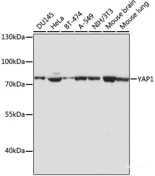 Immunohistochemistry of paraffin-embedded Rat kidney using DCK Polyclonal Antibody at dilution of  1:100 (40x lens).