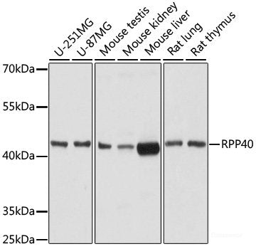 Immunohistochemistry of paraffin-embedded Rat pancreas using CYP24A1 Polyclonal Antibody at dilution of  1:200 (40x lens).