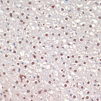Immunofluorescence analysis of Rat thymus using ICOS Polyclonal Antibody at dilution of  1:100. Blue: DAPI for nuclear staining.