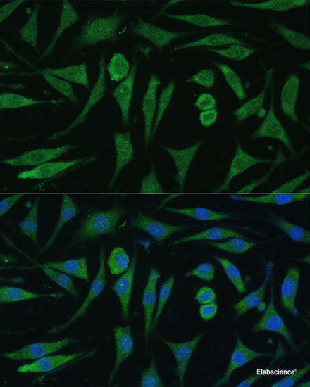 Immunofluorescence analysis of C6 cells using Pan-AKT Polyclonal Antibody at dilution of  1:100. Blue: DAPI for nuclear staining.