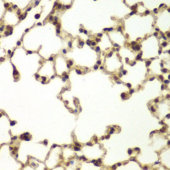 Immunofluorescence analysis of C6 cells using ASPM Polyclonal Antibody at dilution of  1:100. Blue: DAPI for nuclear staining.