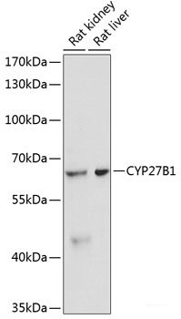 Immunohistochemistry of paraffin-embedded Rat kidney using KEAP1 Polyclonal Antibody at dilution of  1:100 (40x lens).