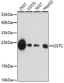 Immunohistochemistry of paraffin-embedded Rat brain using CARTPT Polyclonal Antibody at dilution of  1:100 (40x lens).