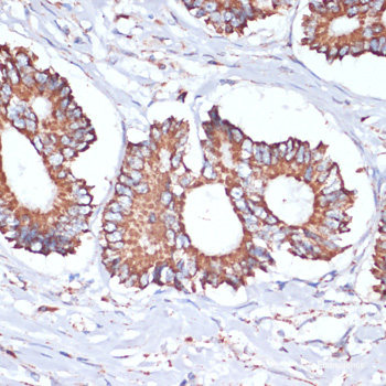 Immunohistochemistry of paraffin-embedded Rat testis using NOTCH1 Polyclonal Antibody at dilution of  1:100 (20x lens).