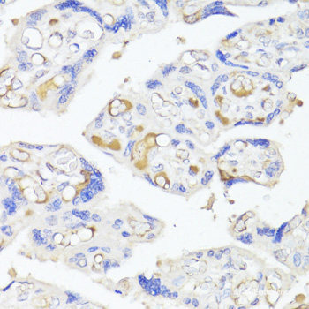 Immunohistochemistry of paraffin-embedded Rat brain using IL10RA Polyclonal Antibody at dilution of  1:200 (40x lens).