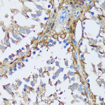Immunohistochemistry of paraffin-embedded Human colon using RNASE3 Polyclonal Antibody at dilution of  1:100 (40x lens).