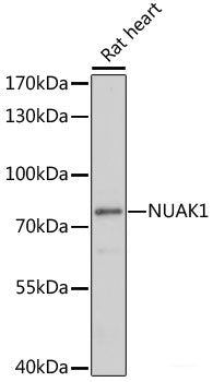 Immunohistochemistry of paraffin-embedded Human liver cancer using DKC1 Polyclonal Antibody at dilution of  1:200 (40x lens).