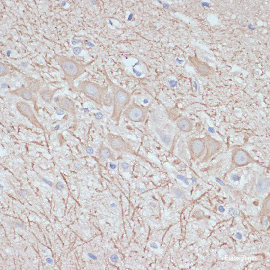Immunofluorescence analysis of A431 cells using LAMC2 Polyclonal Antibody at dilution of  1:100 (40x lens). Blue: DAPI for nuclear staining.