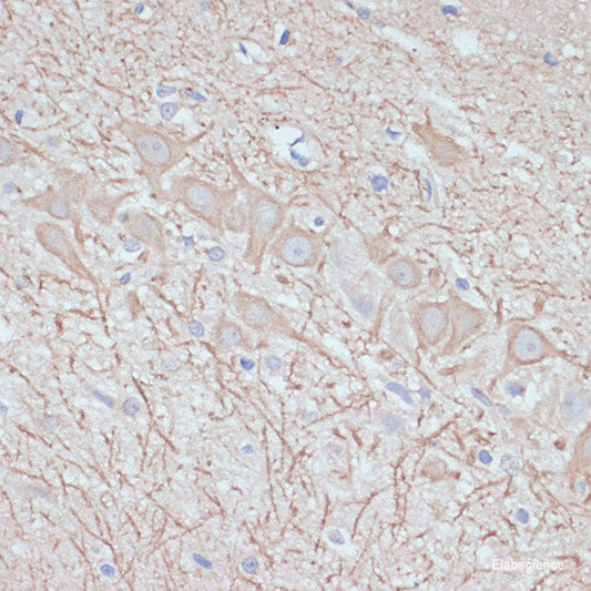 Immunofluorescence analysis of A431 cells using LAMC2 Polyclonal Antibody at dilution of  1:100 (40x lens). Blue: DAPI for nuclear staining.