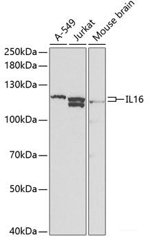 Immunohistochemistry of paraffin-embedded Rat kidney using LIPG Polyclonal Antibody at dilution of  1:200 (40x lens).