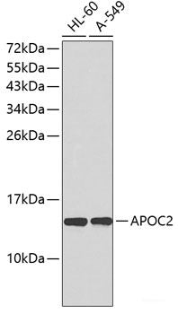 Immunohistochemistry of paraffin-embedded Human stomach using IL11 Polyclonal Antibody at dilution of  1:100 (40x lens).