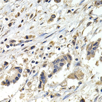 Immunohistochemistry of paraffin-embedded Rat kidney using FHL2 Polyclonal Antibody at dilution of  1:100 (40x lens).