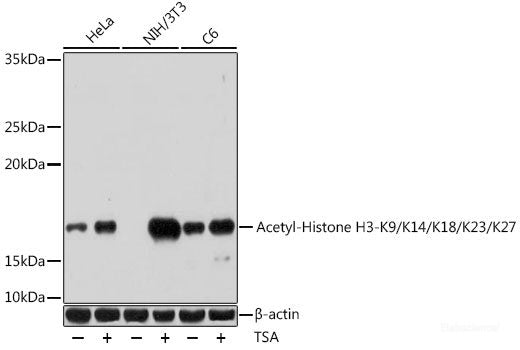 Immunohistochemistry of paraffin-embedded Human esophageal cancer using GPX4 Polyclonal Antibody at dilution of  1:200 (40x lens).