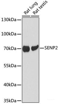 Immunohistochemistry of paraffin-embedded Rat lung using S100A7 Polyclonal Antibody at dilution of  1:100 (40x lens).