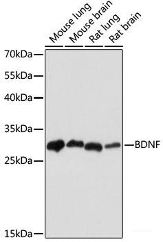 Immunohistochemistry of paraffin-embedded Human colon carcinoma using CDC27 Polyclonal Antibody at dilution of  1:200 (40x lens).