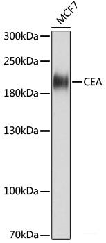 Immunohistochemistry of paraffin-embedded Human lung cancer using MCM6 Polyclonal Antibody at dilution of  1:100 (40x lens).