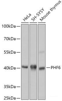 Immunohistochemistry of paraffin-embedded Rat kidney using CCL22 Polyclonal Antibody at dilution of  1:100 (40x lens).