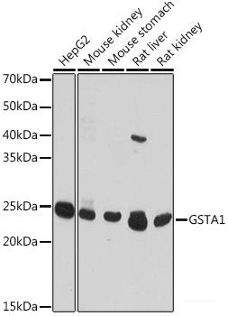 Immunohistochemistry of paraffin-embedded Human esophagus using MVP Polyclonal Antibody at dilution of  1:100 (40x lens).