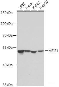 Immunohistochemistry of paraffin-embedded Human lung using ACVR2A Polyclonal Antibody at dilution of  1:100 (40x lens).