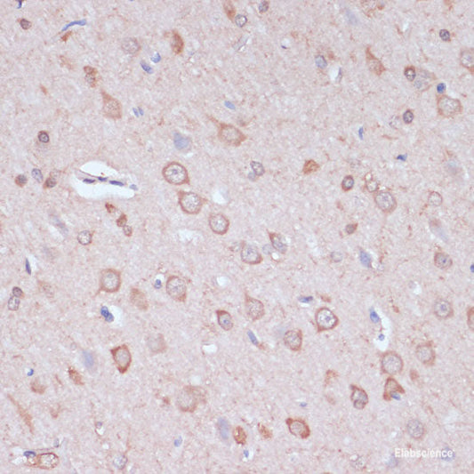 Immunofluorescence analysis of HeLa cells using CYP27A1 Polyclonal Antibody at dilution of  1:100 (40x lens). Blue: DAPI for nuclear staining.