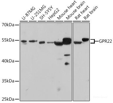 Immunohistochemistry of paraffin-embedded Rat spleen using APCS Polyclonal Antibody at dilution of  1:100 (40x lens).