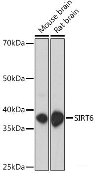 Immunohistochemistry of paraffin-embedded Human liver damage using CBLB Polyclonal Antibody at dilution of  1:200 (40x lens).