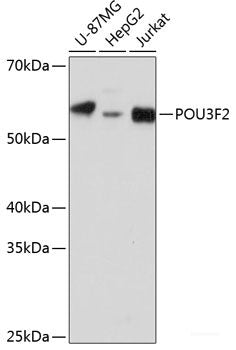 Immunohistochemistry of paraffin-embedded Rat spleen using NT5E / CD73 Polyclonal Antibody at dilution of  1:200 (40x lens).