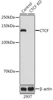 Immunohistochemistry of paraffin-embedded Rat lung using CDKN2C Polyclonal Antibody at dilution of  1:100 (40x lens).