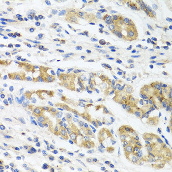 Immunohistochemistry of paraffin-embedded Mouse liver using FGFR1 Polyclonal Antibody at dilution of  1:100 (40x lens).