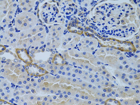 Immunofluorescence analysis of U2OS cells using KU70 Polyclonal Antibody at dilution of  1:100. Blue: DAPI for nuclear staining.