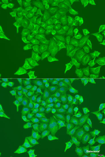 Immunohistochemistry of paraffin-embedded Rat kidney using HDAC2 Polyclonal Antibody at dilution of  1:100 (40x lens).