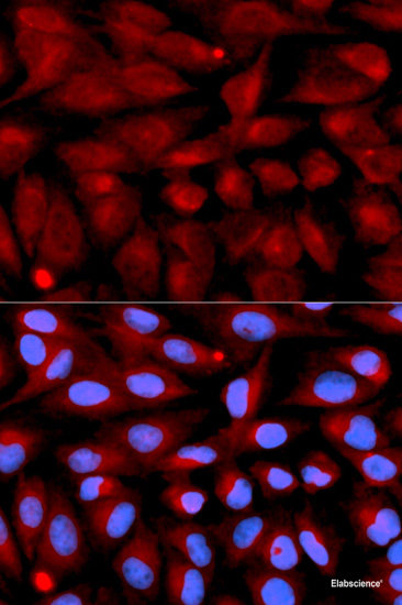 Immunofluorescence analysis of C6 cells using MAP2K7 Polyclonal Antibody at dilution of  1:100. Blue: DAPI for nuclear staining.