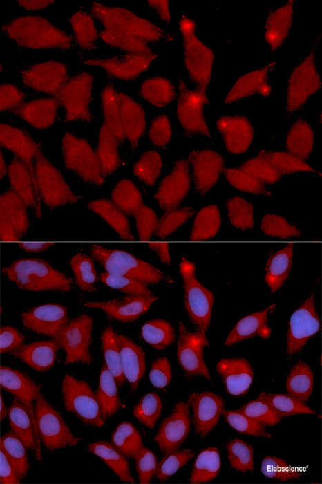 Immunohistochemistry of paraffin-embedded Rat heart using OGT Polyclonal Antibody at dilution of  1:100 (40x lens).