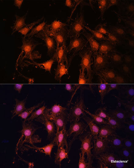 Immunohistochemistry of paraffin-embedded Mouse kidney using TSG101 Polyclonal Antibody at dilution of  1:100 (40x lens).