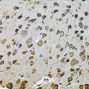 Immunohistochemistry of paraffin-embedded Mouse heart using HSPB2 Polyclonal Antibody at dilution of  1:200 (40x lens).