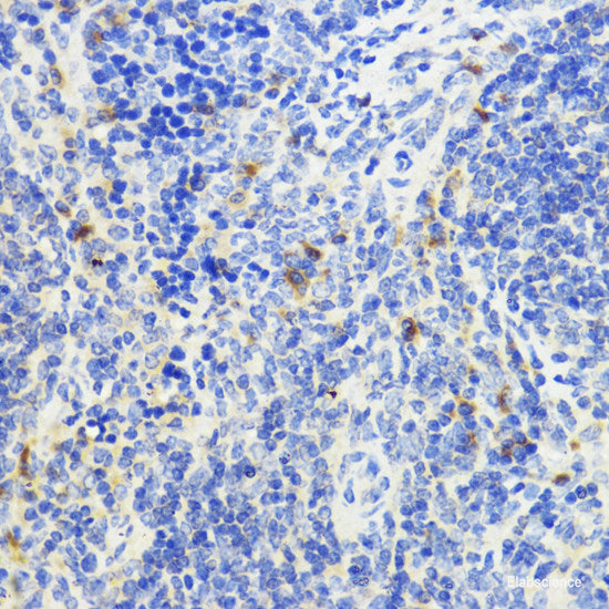 Immunohistochemistry of paraffin-embedded Rat brain using AXIN2 Polyclonal Antibody at dilution of  1:100 (40x lens).