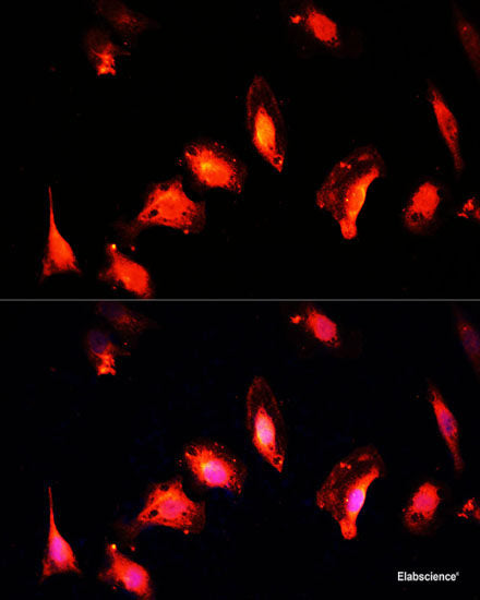 Immunohistochemistry of paraffin-embedded Human stomach using NF-kB p65 Polyclonal Antibody at dilution of  1:200 (40x lens).