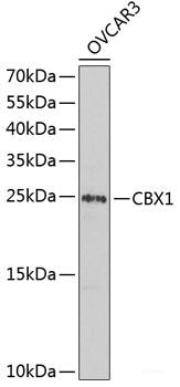 Immunohistochemistry of paraffin-embedded Rat heart using IRF2 Polyclonal Antibody at dilution of  1:200 (40x lens).