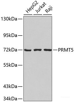 Immunohistochemistry of paraffin-embedded Mouse lung using SKP1 Polyclonal Antibody at dilution of  1:100 (40x lens).